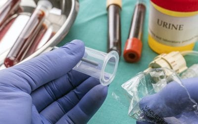 Understanding Urine Samples and Blood Testing During Drug Treatment and Recovery